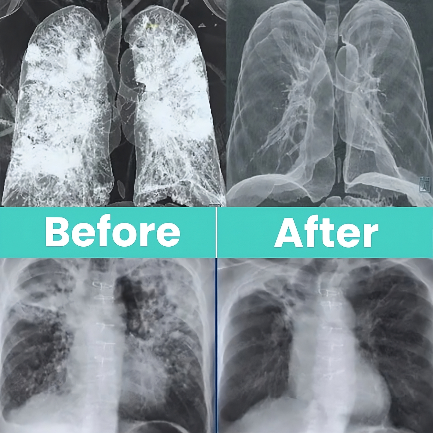 Lung Detox Spray